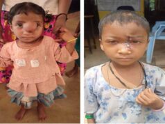 पिता के संघर्ष को मिला साथ – चिरायु योजना ने बचाई अंजलि की जिंदगी